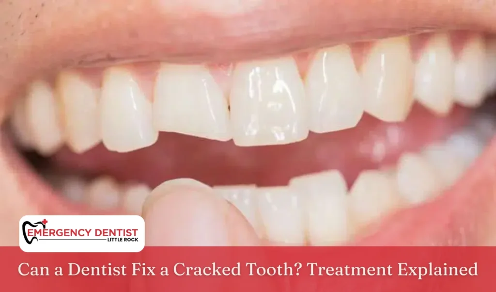 Can a Dentist Fix a Cracked Tooth Treatment Explained