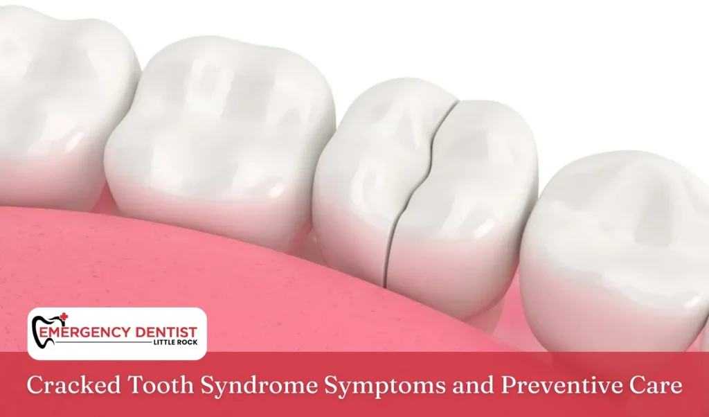 Cracked Tooth Syndrome Symptoms and Preventive Care