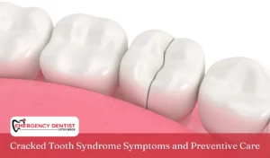 Cracked Tooth Syndrome Symptoms and Preventive Care