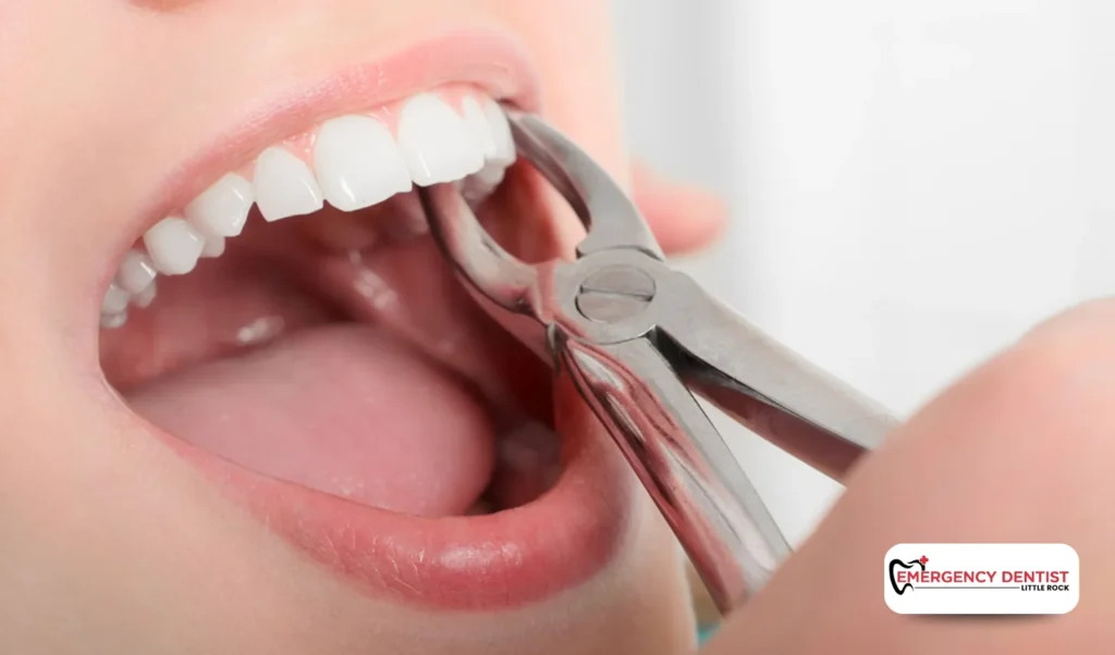 Recognizing Signs of Complications