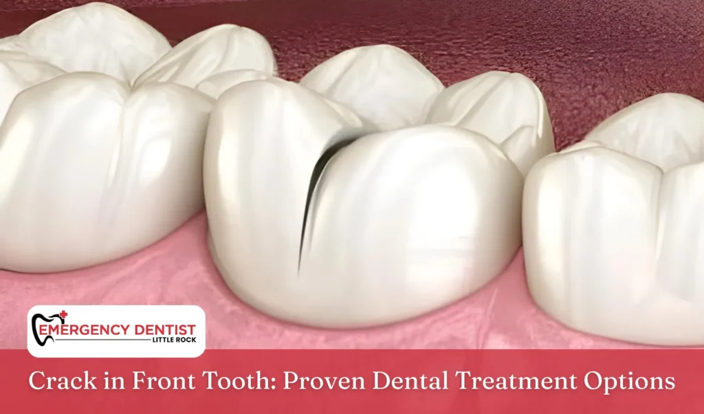 Crack in Front Tooth Proven Dental Treatment Options