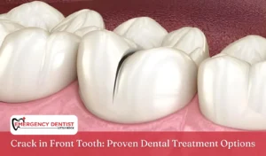 Crack in Front Tooth Proven Dental Treatment Options