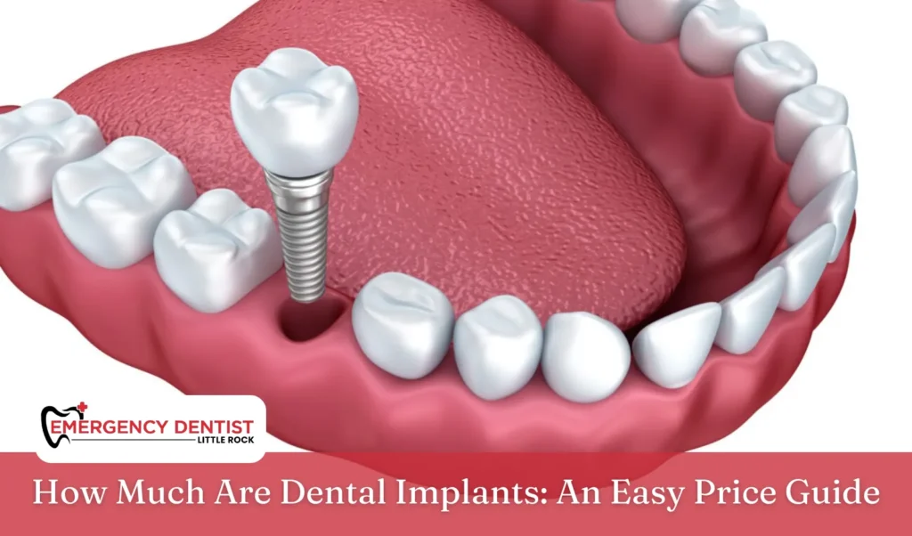 How Much Are Dental Implants An Easy Price Guide