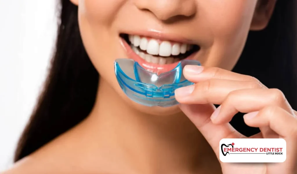 The Role of Mouth Guards in Preventing Dental Injuries