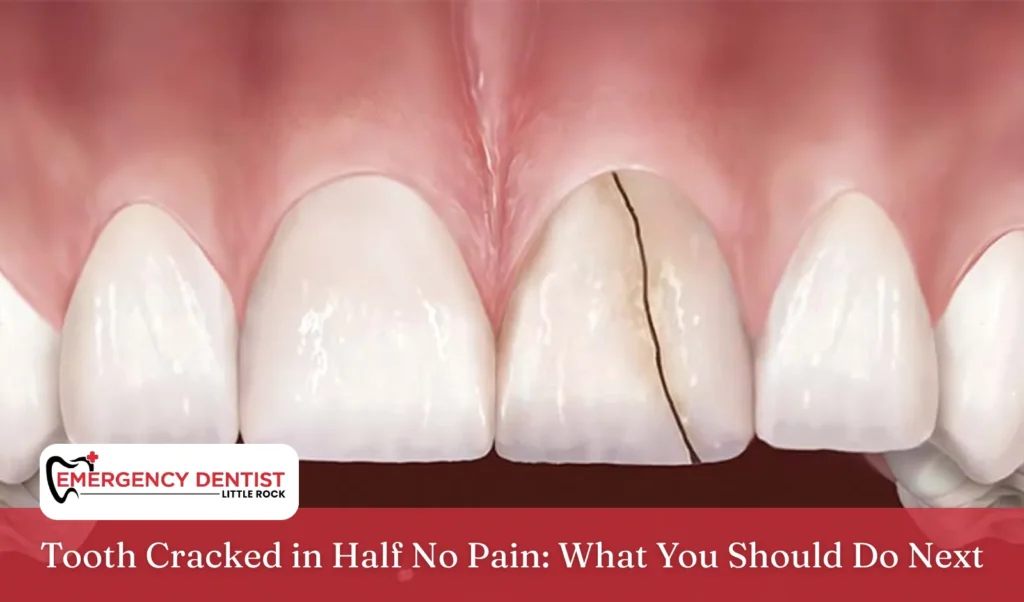 Tooth Cracked in Half No Pain What You Should Do Next