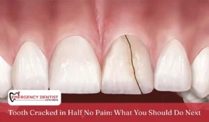 Tooth Cracked in Half No Pain What You Should Do Next
