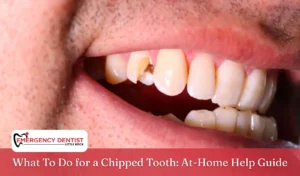 What To Do for a Chipped Tooth At-Home Help Guide