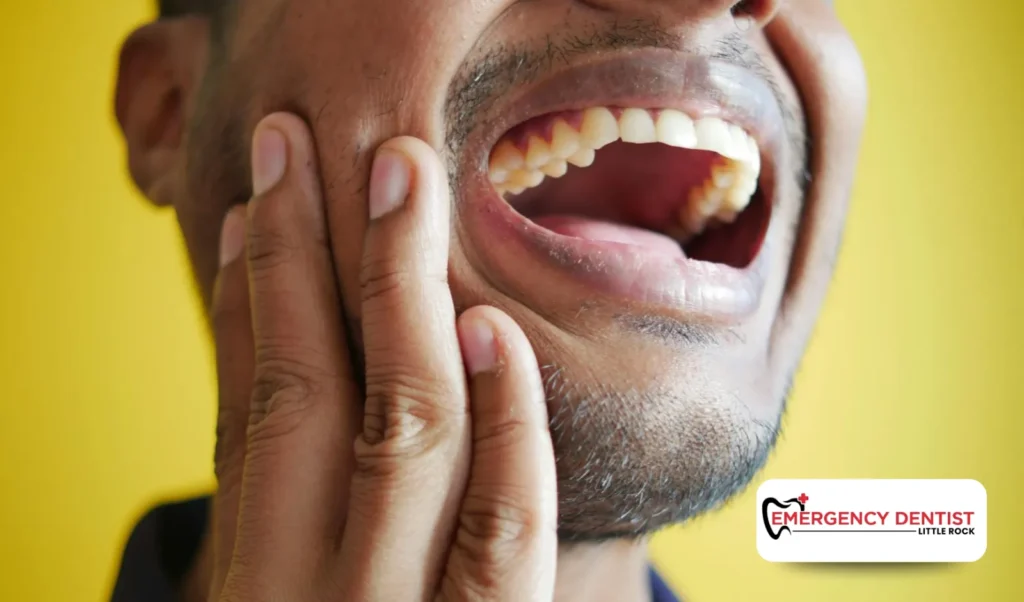 When to Call an Emergency Dentist in Little Rock