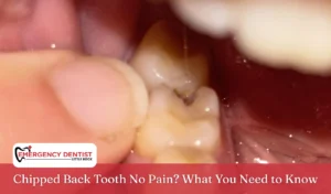 Chipped Back Tooth No Pain What You Need to Know