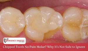 Chipped Tooth No Pain Molar Why It’s Not Safe to Ignore