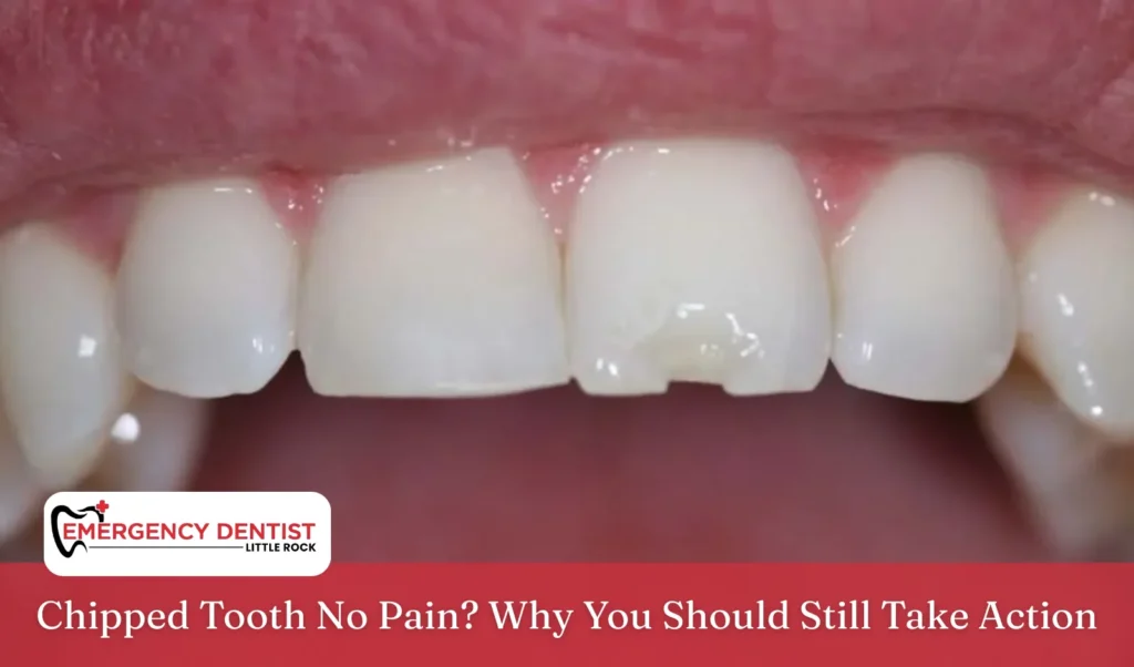 Chipped Tooth No Pain Why You Should Still Take Action