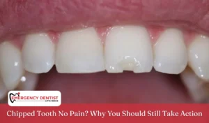 Chipped Tooth No Pain Why You Should Still Take Action