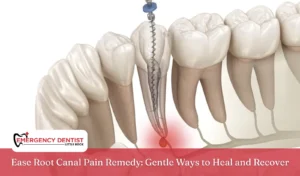 Ease Root Canal Pain Remedy Gentle Ways to Heal and Recover
