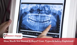 How Much Are Dental X-Rays Cost, Types & Safety Explained