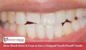 How Much Does It Cost to Get a Chipped Tooth Fixed Guide