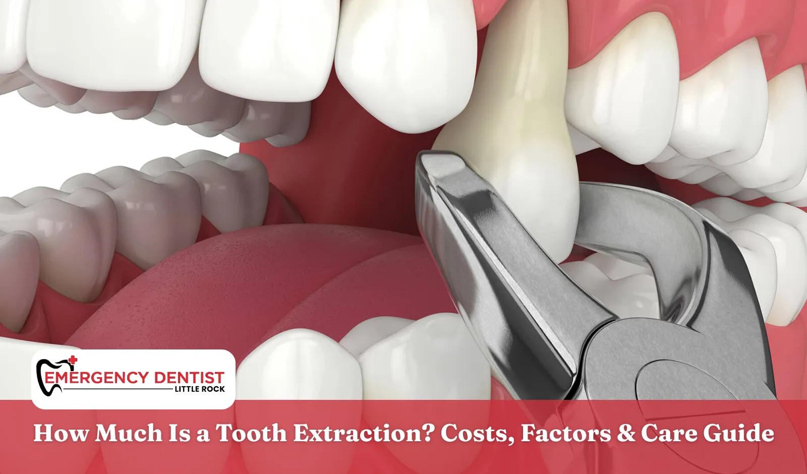 How Much Is a Tooth Extraction? Costs, Factors & Care Guide