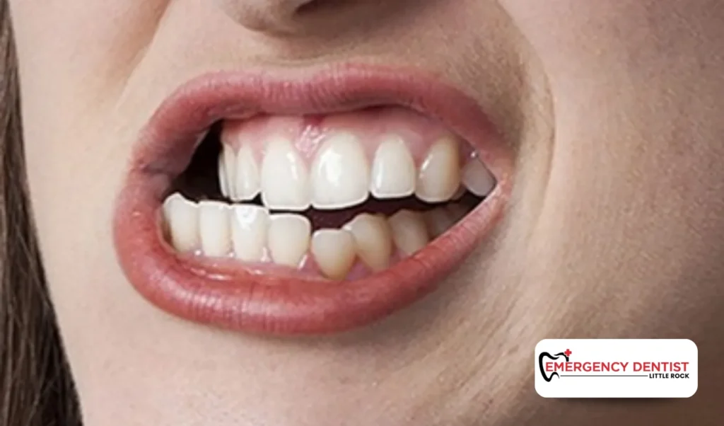 Key Factors That Affect Implant Longevity