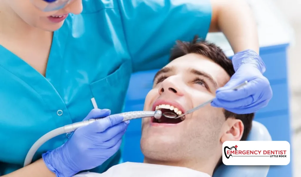 Key Factors That Influence the Cost for Root Canal Treatment