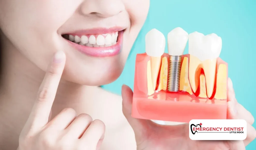 Long-Term Success and Care