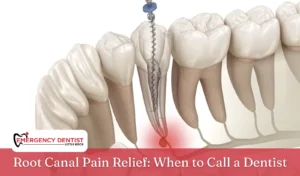 Root Canal Pain Relief When to Call a Dentist