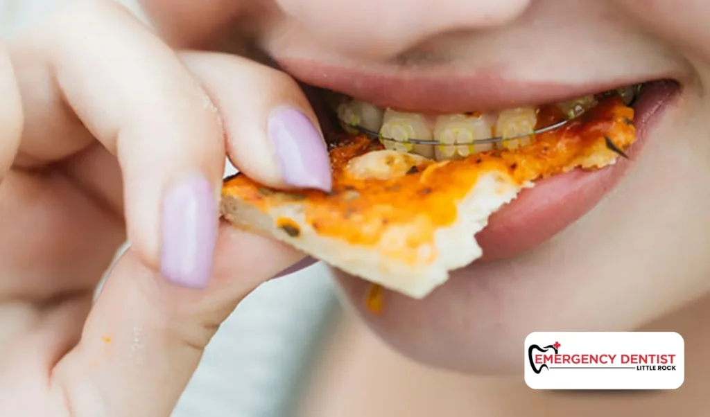 What Causes a Chipped Back Tooth With No Pain