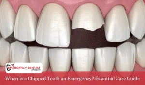 When Is a Chipped Tooth an Emergency Essential Care Guide