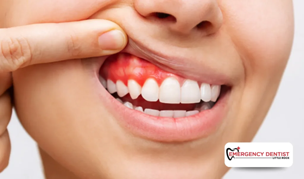 When to Contact an Emergency Dentist in Little Rock