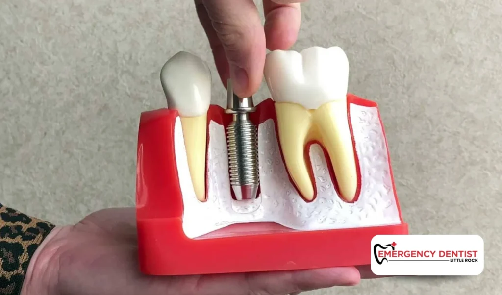 When to Seek a Professional Help