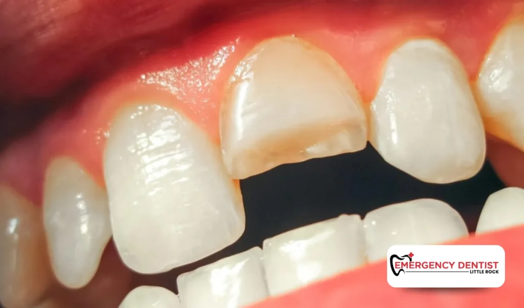 Why Emergency Dentistry May Be Needed