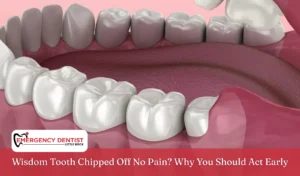 Wisdom Tooth Chipped Off No Pain Why You Should Act Early