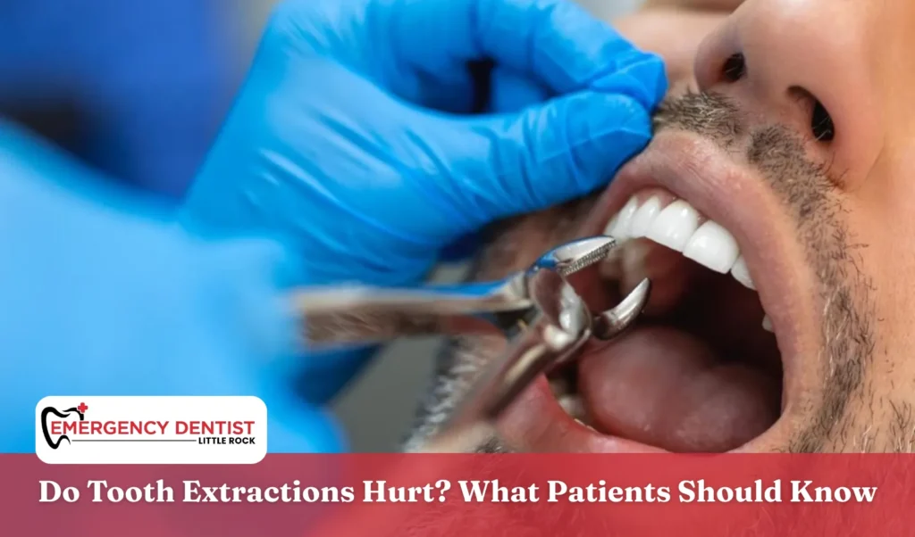 Do Tooth Extractions Hurt What Patients Should Know