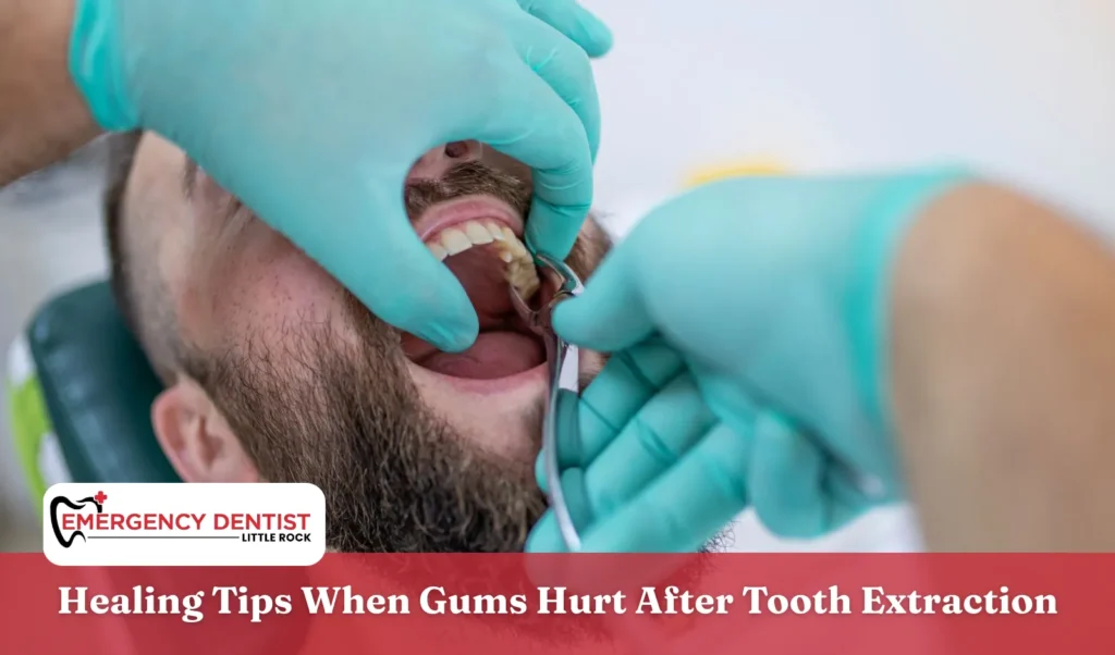 Healing Tips When Gums Hurt After Tooth Extraction