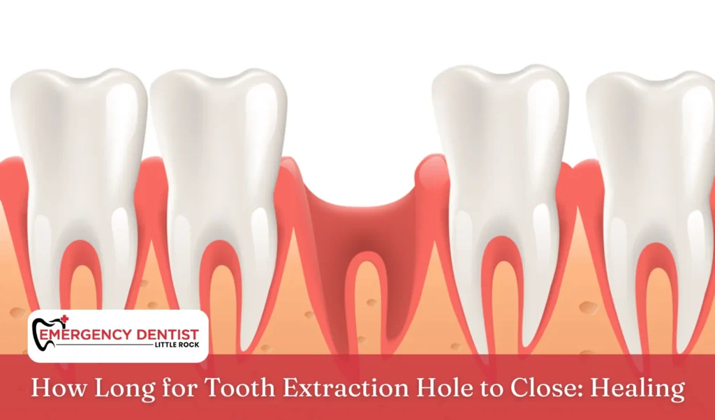 How Long for Tooth Extraction Hole to Close Healing