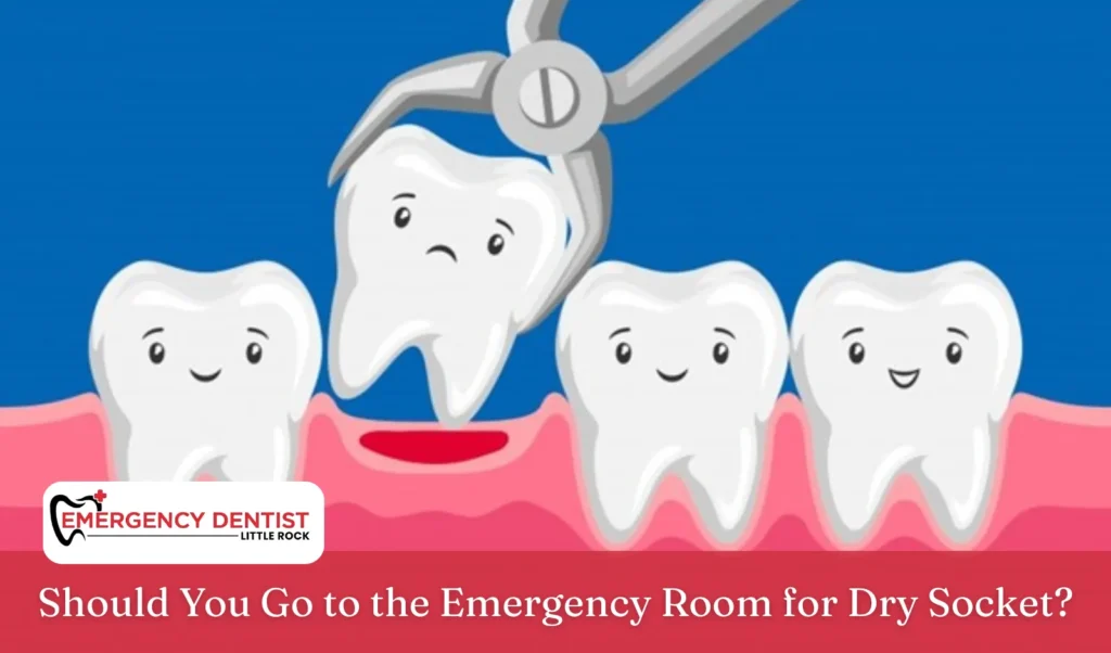 Should You Go to the Emergency Room for Dry Socket