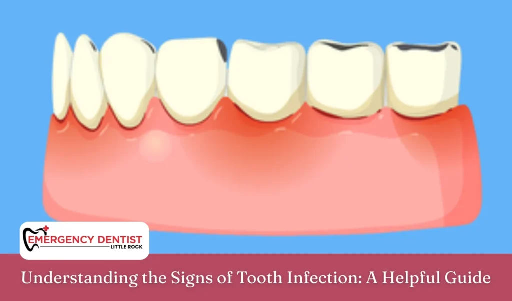 Understanding the Signs of Tooth Infection A Helpful Guide