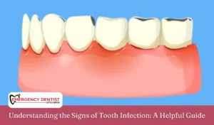 Understanding the Signs of Tooth Infection A Helpful Guide