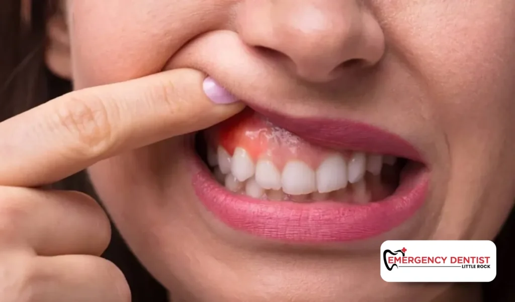 When Gum Pain Is Normal and When It Isn’t