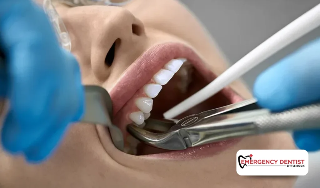 Common Signs of Infected Teeth