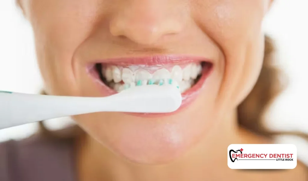 Helpful Steps While Waiting for Dental Care