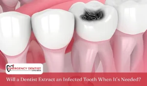 Will a Dentist Extract an Infected Tooth When It’s Needed