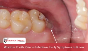 Wisdom Tooth Pain vs Infection Early Symptoms to Know