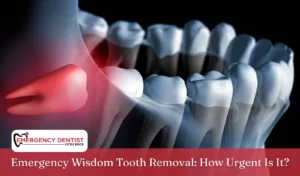 Emergency Wisdom Tooth Removal How Urgent Is It