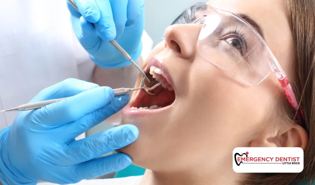 How to Remove a Wisdom Tooth: Procedure Overview