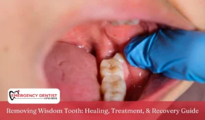 Removing Wisdom Tooth Healing, Treatment, & Recovery Guide