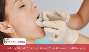How Long Should You Keep Gauze After Wisdom Tooth Surgery