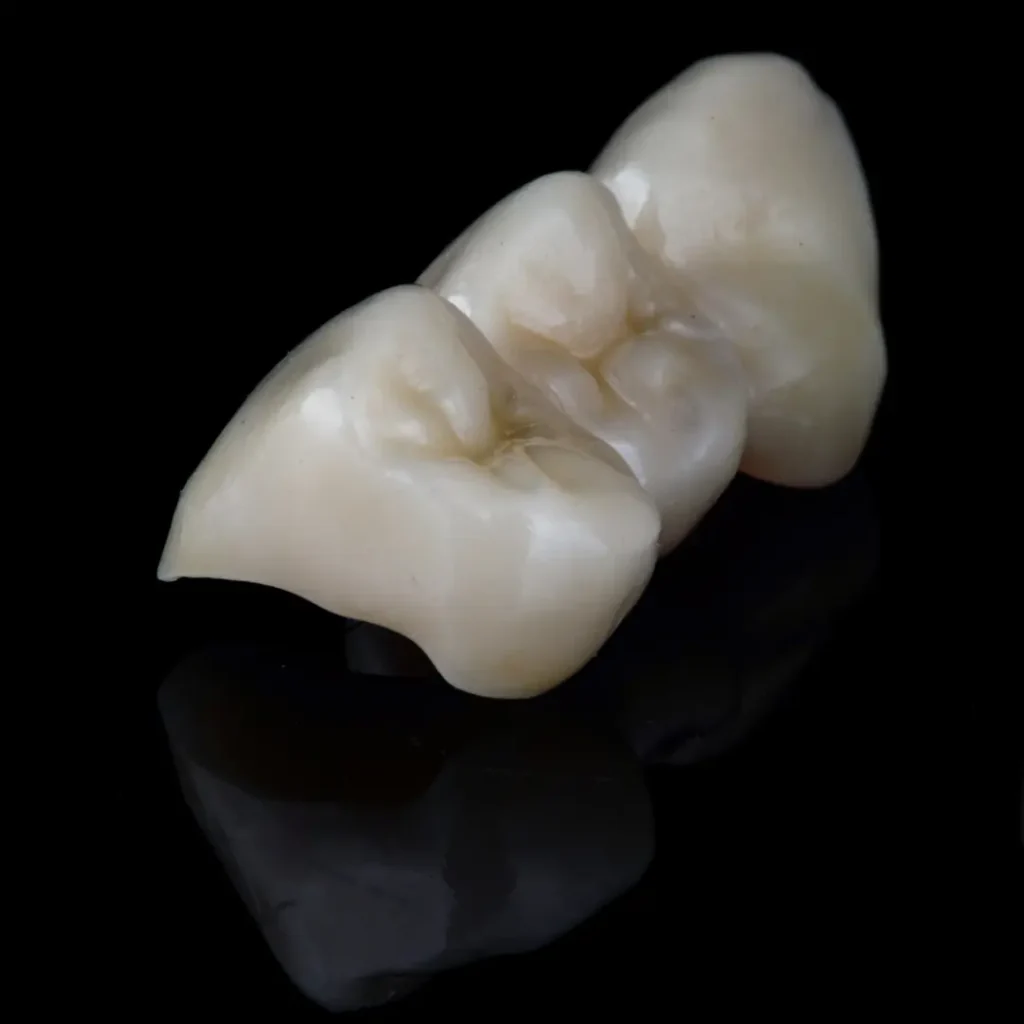 Broken-or-cracked-dental-bridge-Little-Rock-AR