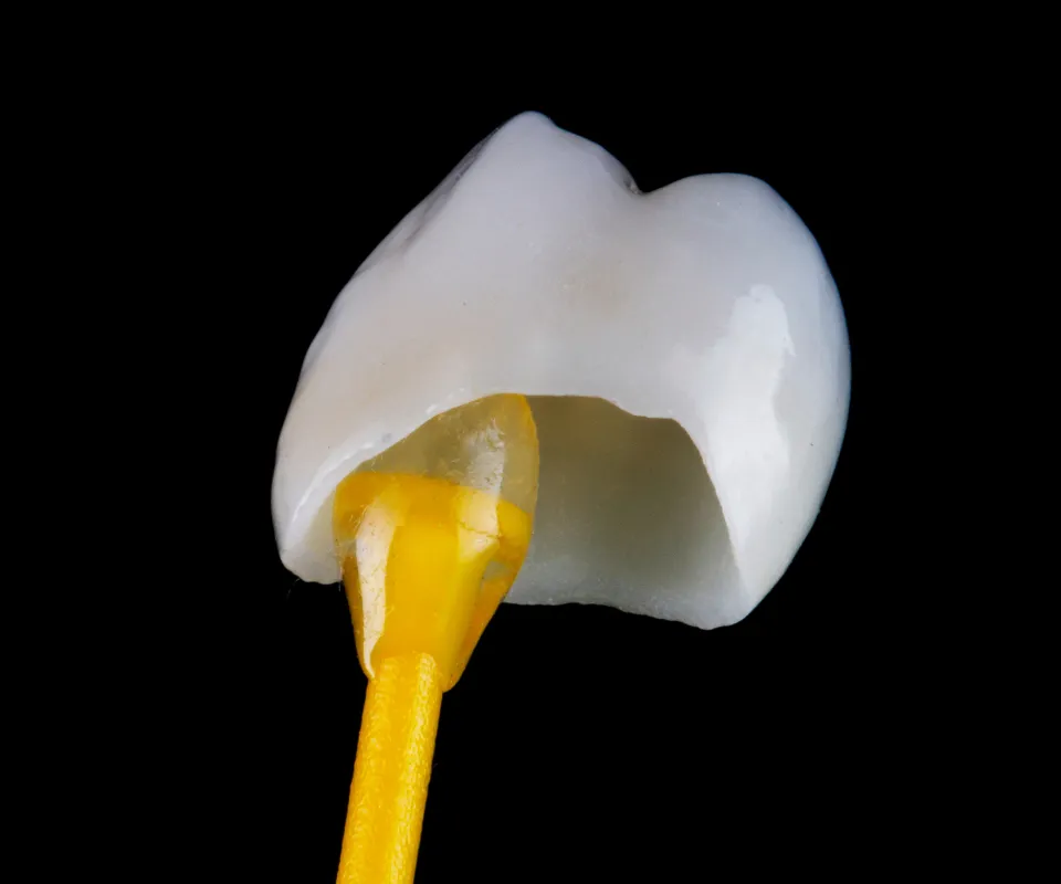 Dental-Crowns-Little-Rock-AR