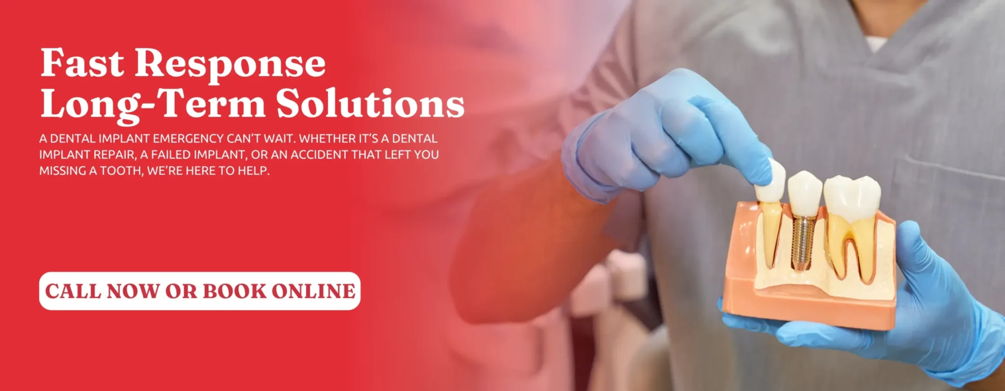 Dental-Implant-Solutions-in-Little-Rock-AR