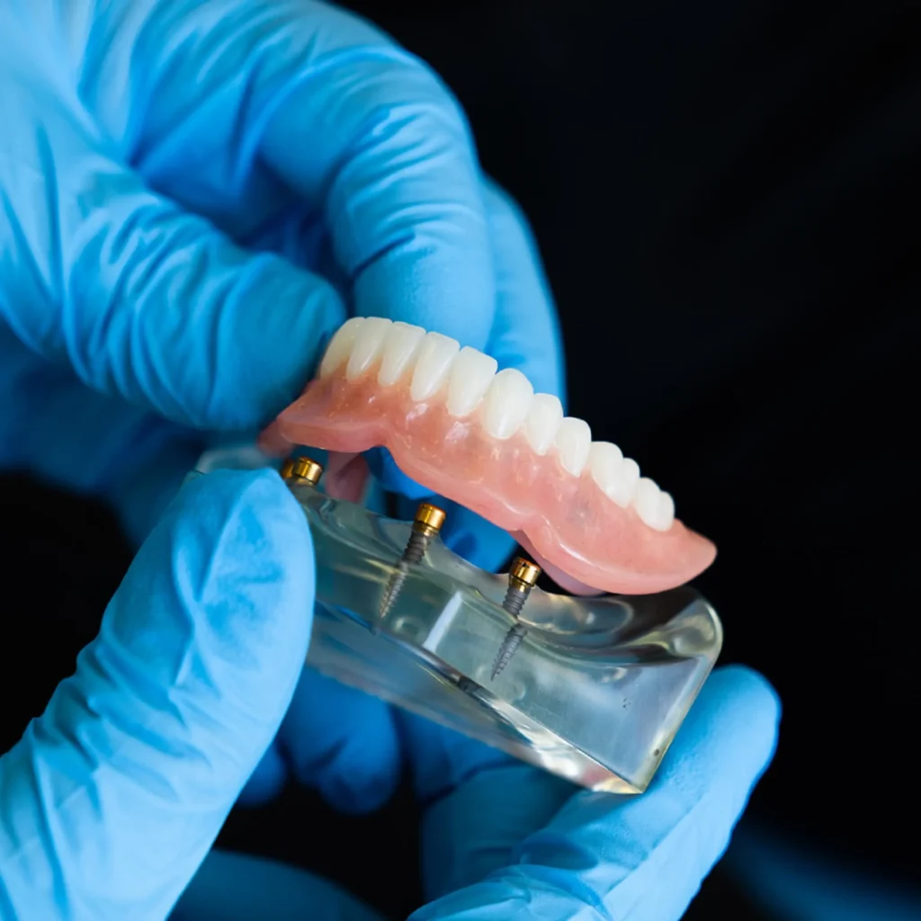 Denture-Repair-Little-Rock-AR