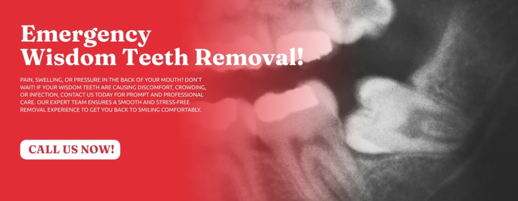 Emergency-Wisdom-Tooth-Removal-Little-Rock-AR